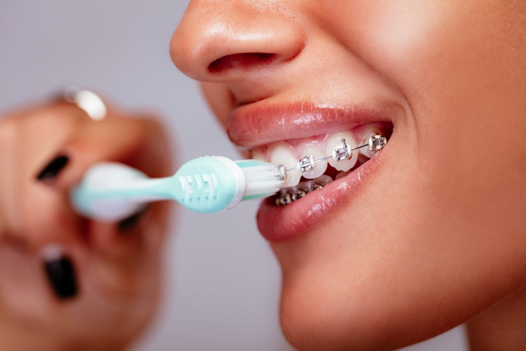 cepillo de dientes para brackets